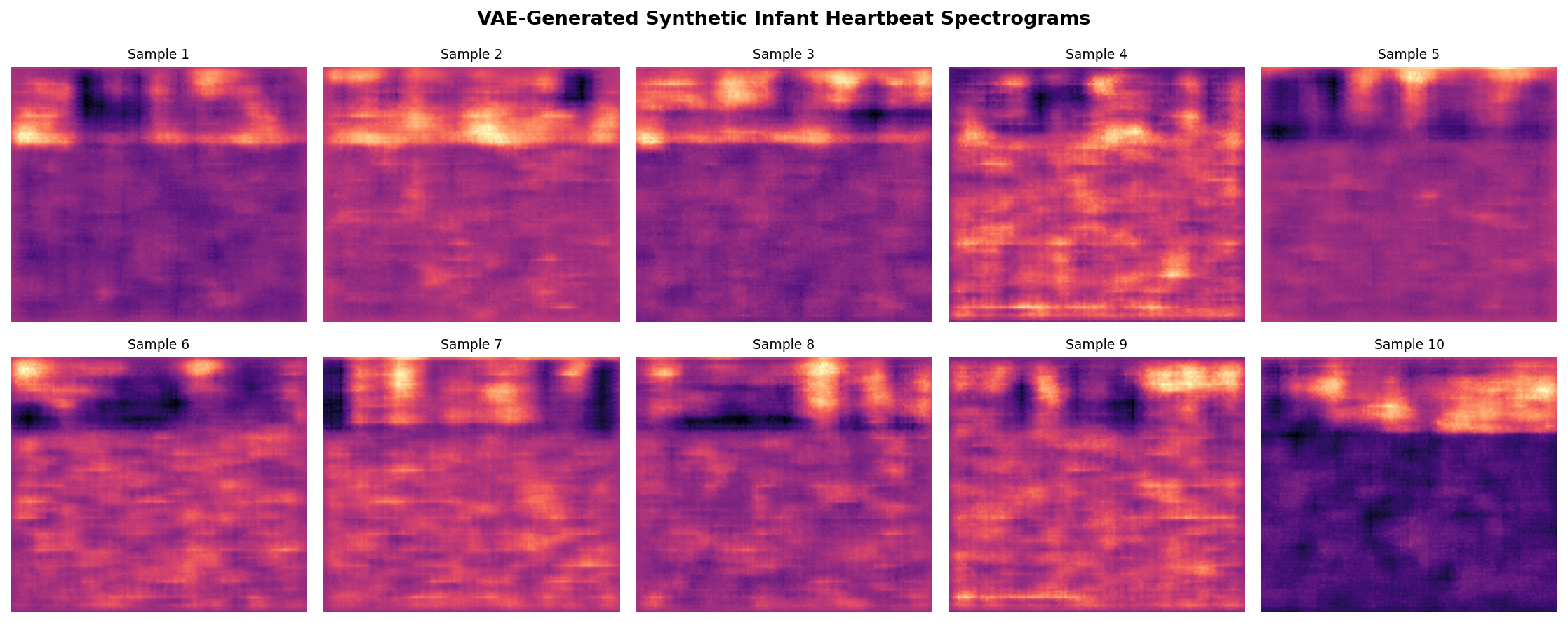 Infant Heartrate Anomaly Detection